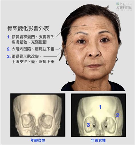 夫妻宮凹陷化解|夫妻宮凹陷為何因？面相學專家揭秘